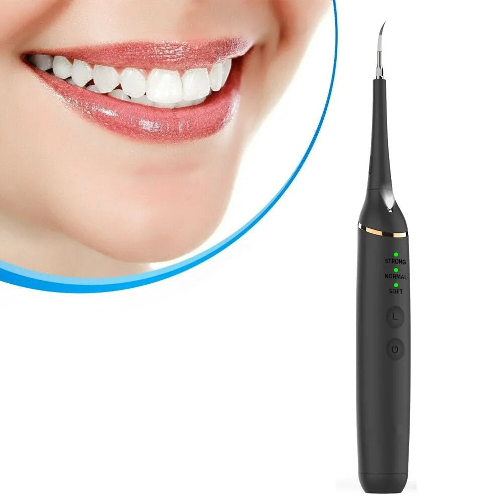 Vibe Geeks Professional Electric Teeth Cleaner Water Flosser- USB Charging-0