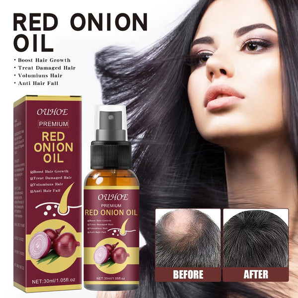Onion Hair Growth Essential Oil, Strengthens And Hydrates Hair Growth Hair Dense Hair Care Spray - Memoriex 